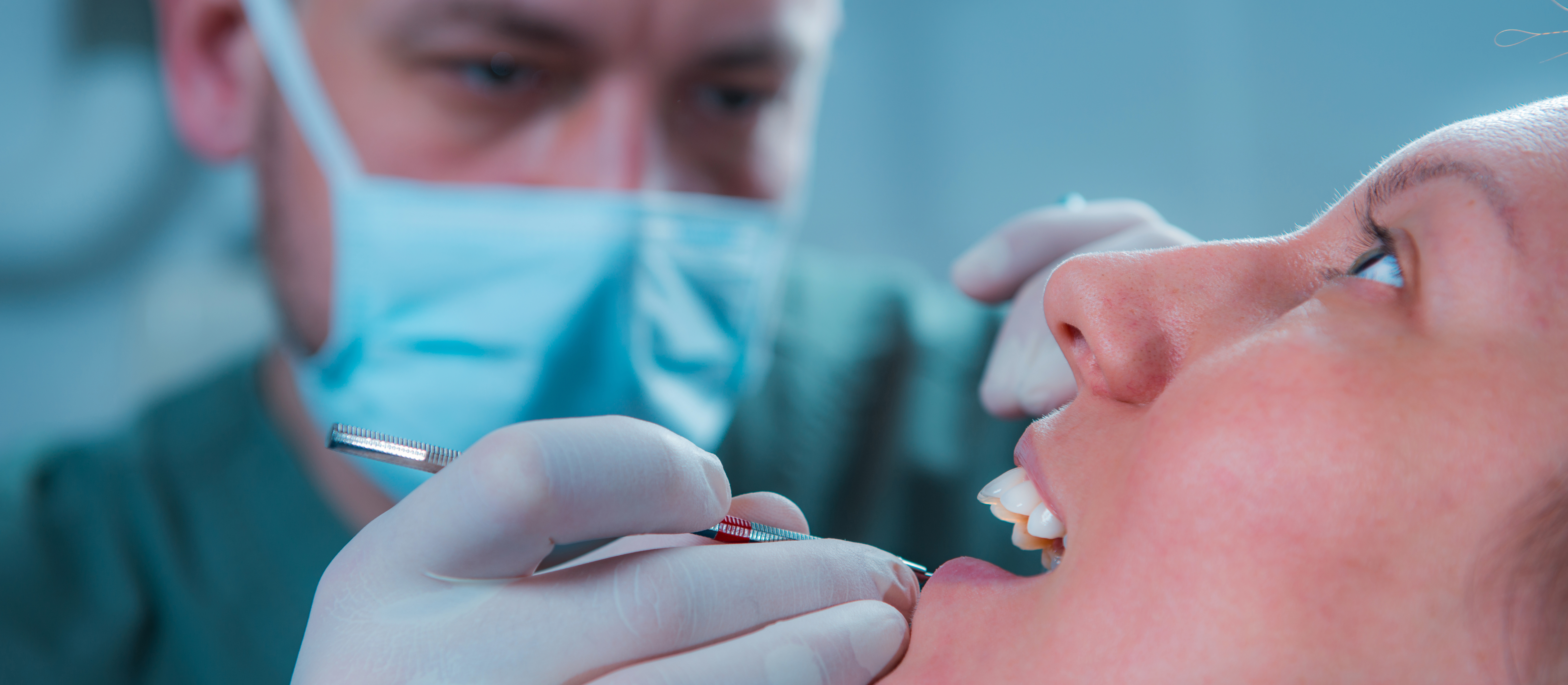 Tooth Extractions