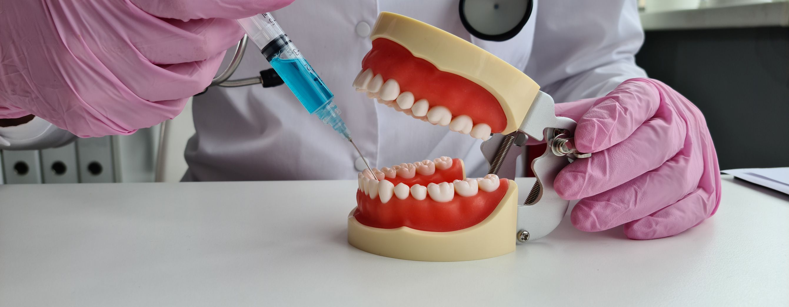 Full Mouth Rehabilitation