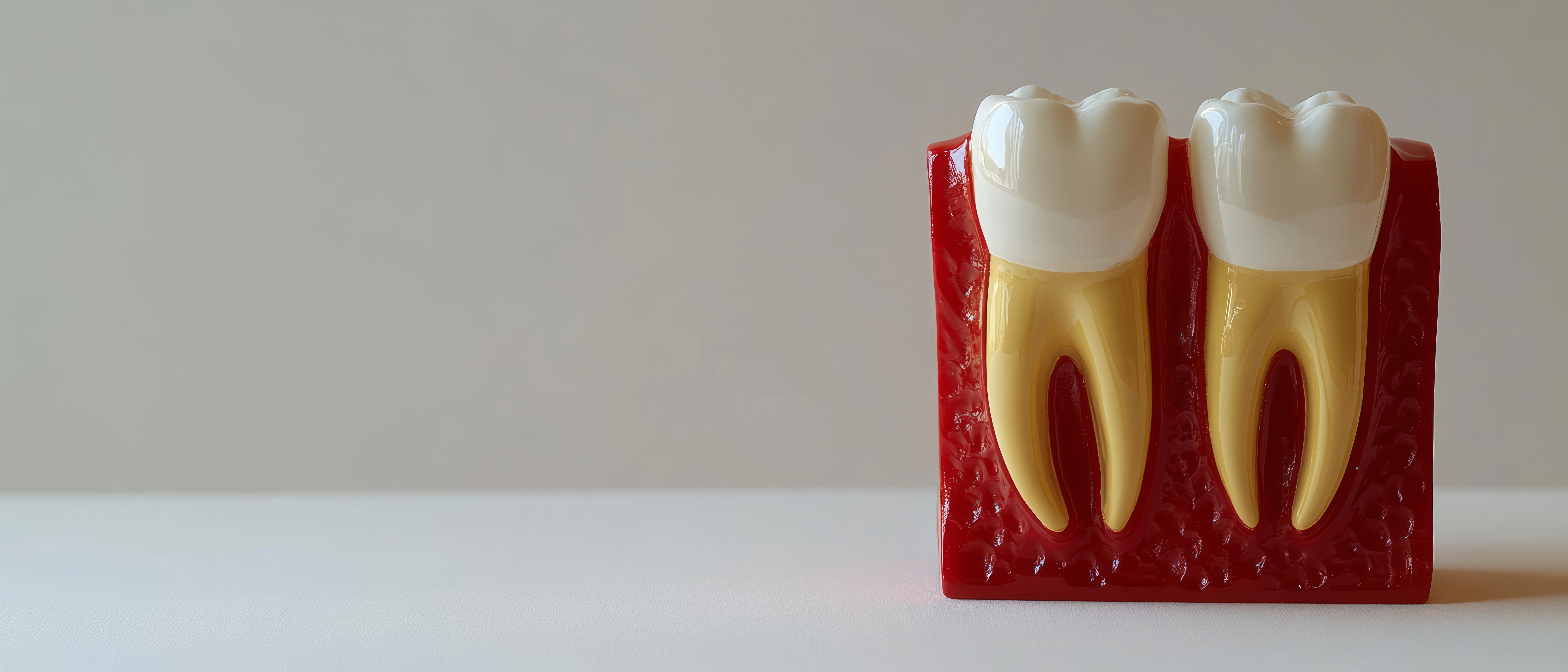 Wisdom Tooth Removal